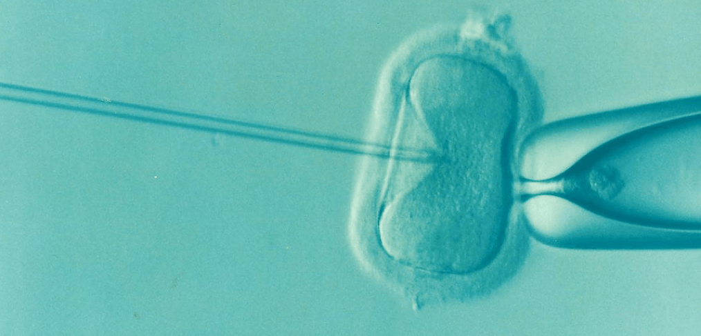 spermi infertili al microscopio